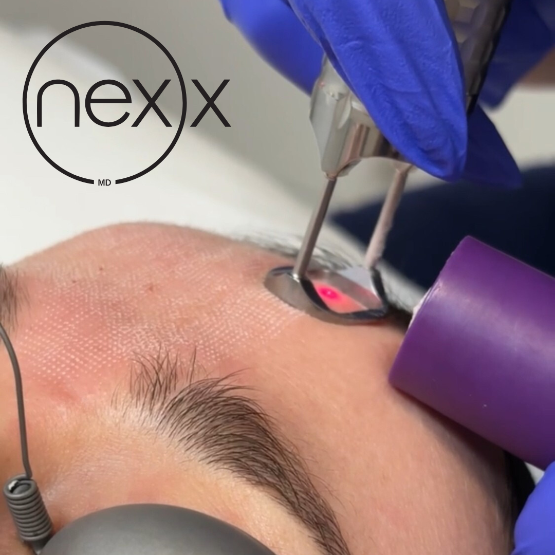 The Restore Protocol